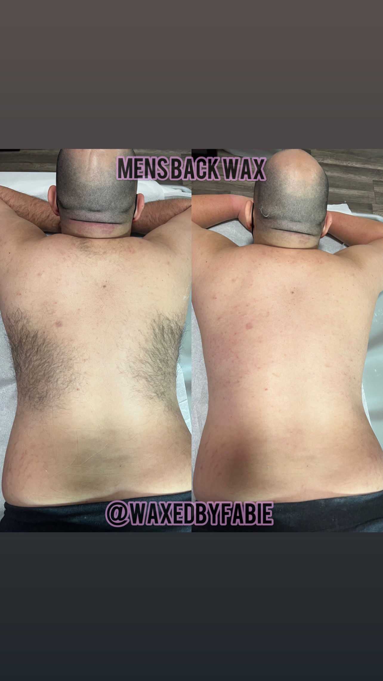 Men's back before and after waxing treatment, showing hair removal results.